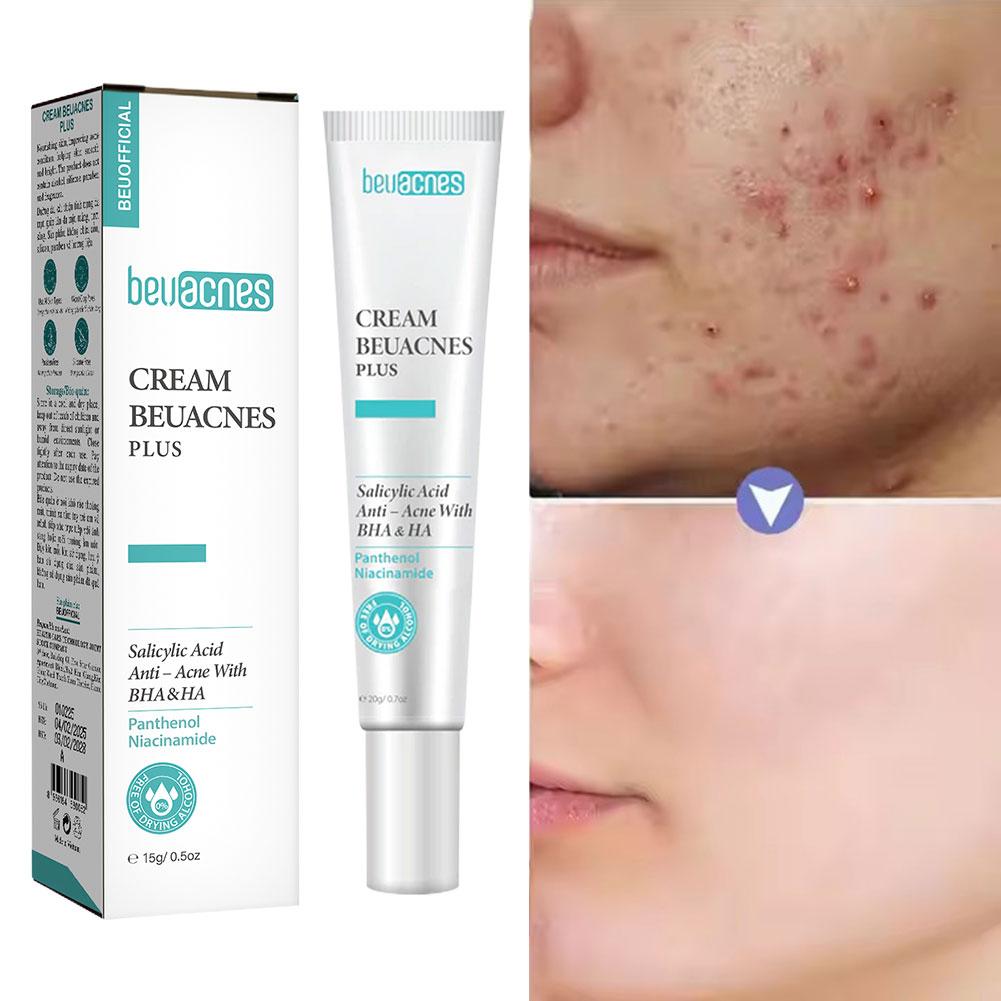 New 20g Niacinamide Acne Gel A - огляд і ціна Skincare Salicylic Acid