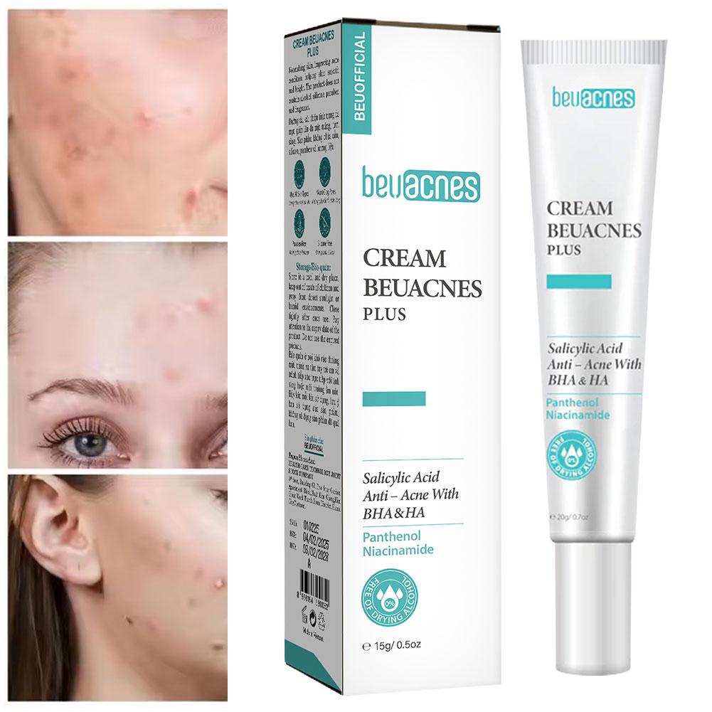 New 20g Niacinamide Acne Gel A - огляд і ціна Skincare Salicylic Acid
