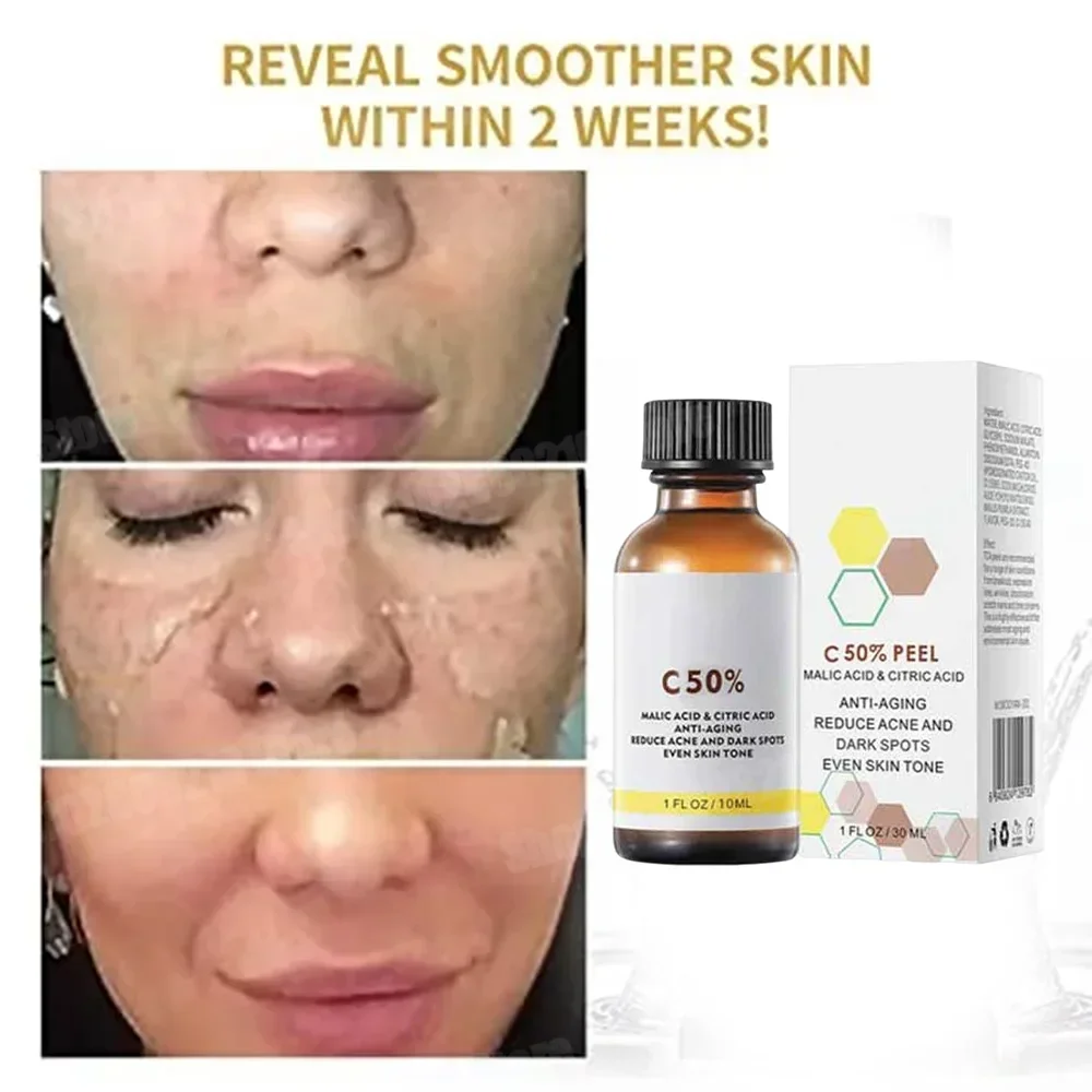 Salicylic Acid Face Facial Pee - огляд і ціна Skincare Salicylic Acid