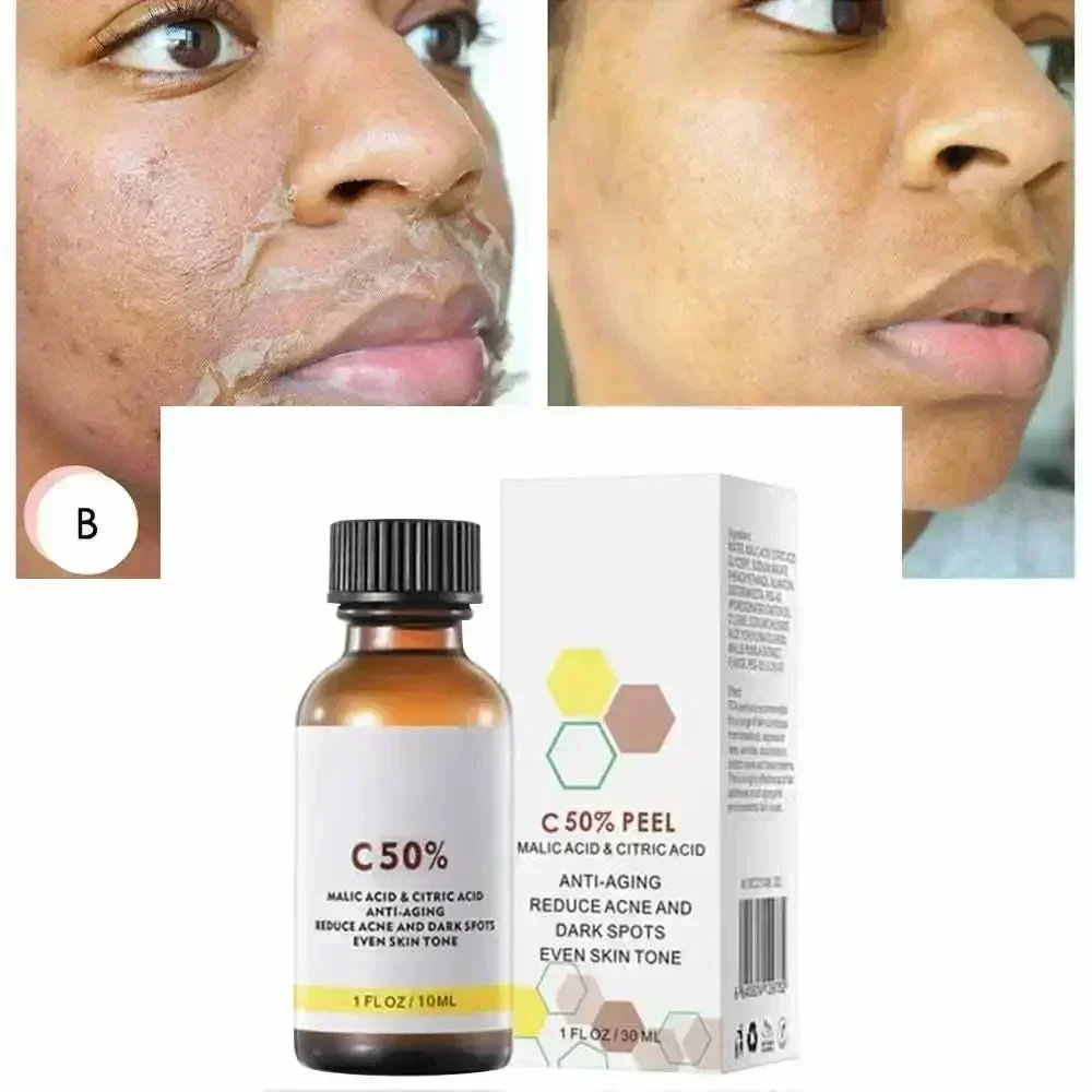 Salicylic Acid Face Facial Pee - огляд і ціна Skincare Salicylic Acid
