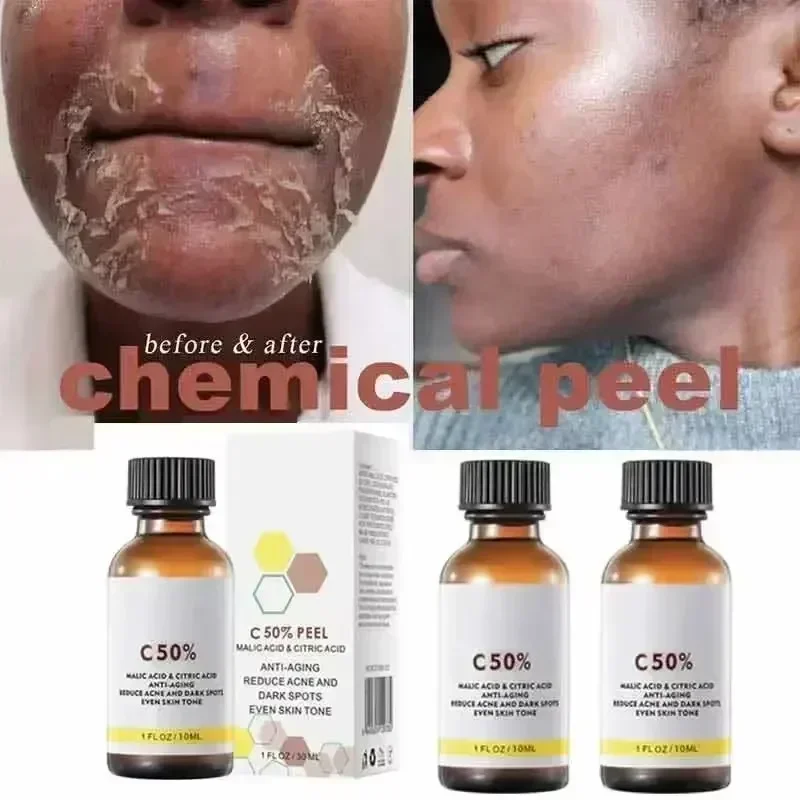 Salicylic Acid Face Facial Pee - огляд і ціна Skincare Salicylic Acid