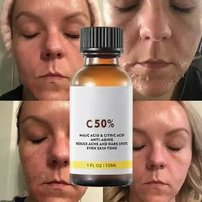 Salicylic Acid Face Facial Pee - огляд і ціна Skincare Salicylic Acid
