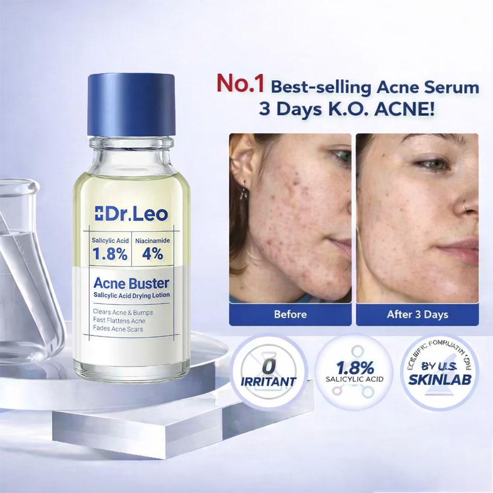Salicylic Acid Essence Treatme - огляд і ціна Skincare Salicylic Acid