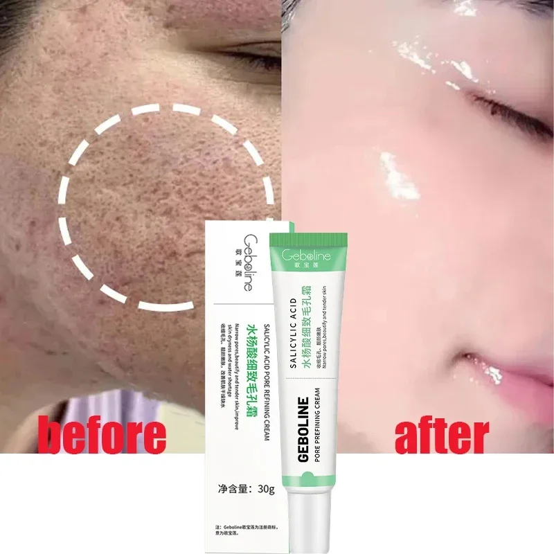 Salicylic Acid Pore Shrinking  - огляд і ціна Skincare Salicylic Acid