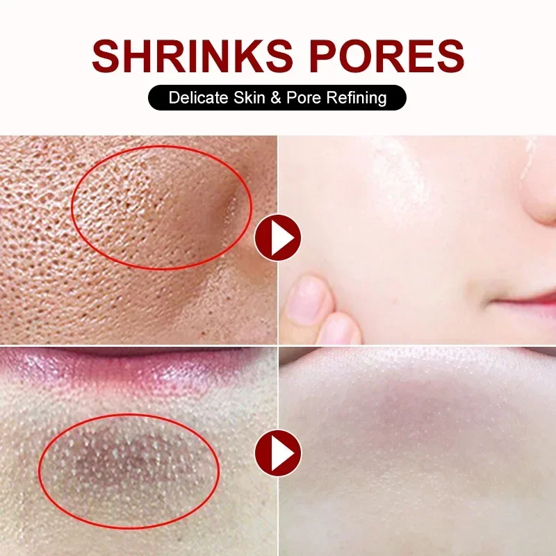 Salicylic Acid Pore Shrinking  - огляд і ціна Skincare Salicylic Acid