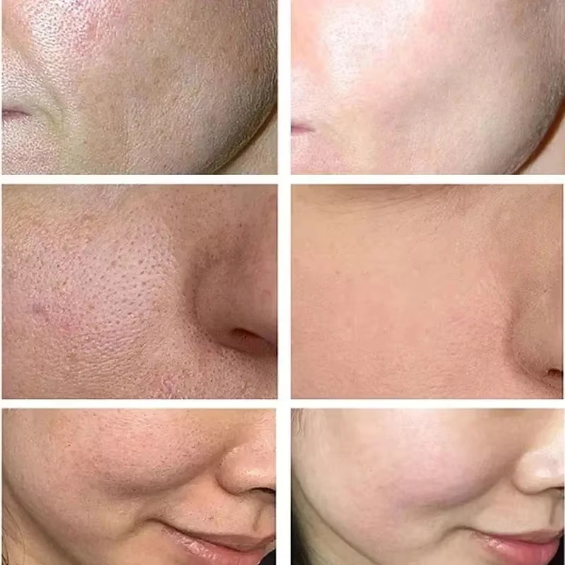 Salicylic Acid Pore Shrinking  - огляд і ціна Skincare Salicylic Acid