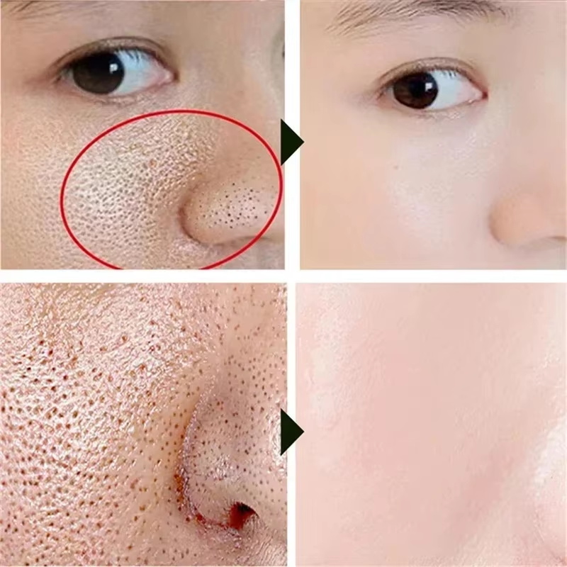 Salicylic Acid Pore Shrinking  - огляд і ціна Skincare Salicylic Acid
