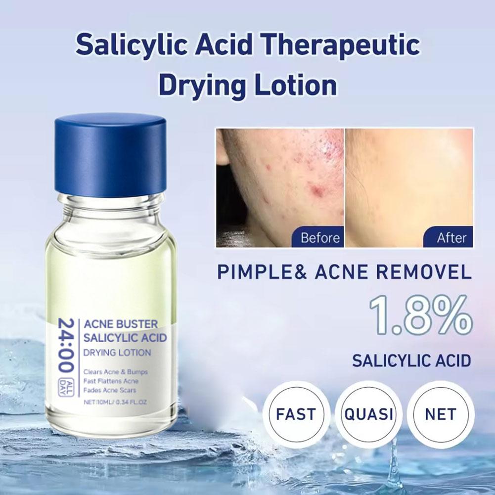 Salicylic Acid Acne Buster Rem - огляд і ціна Skincare Salicylic Acid